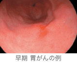 endoscope_4 endoscope_4
